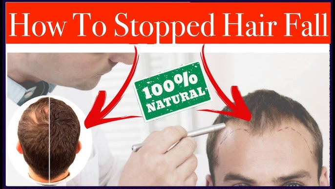 हेयर फॉल रोकने के उपाय